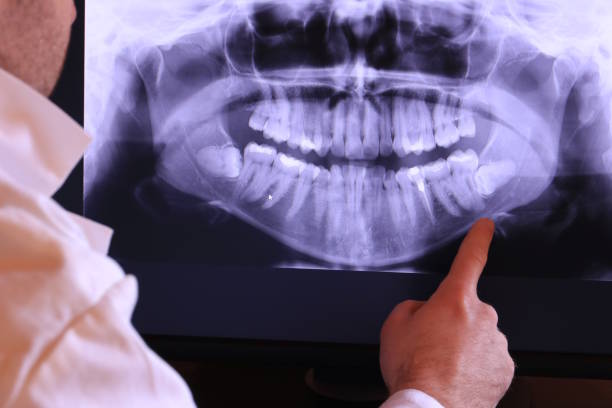 Best Emergency Wisdom Teeth Removal in Selbyville, DE
