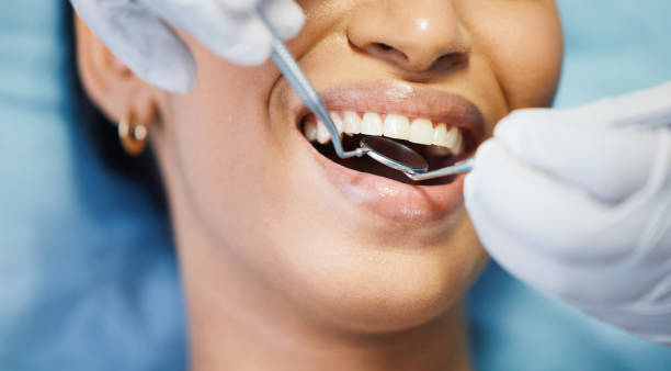 Best Emergency Tooth Extraction in Selbyville, DE