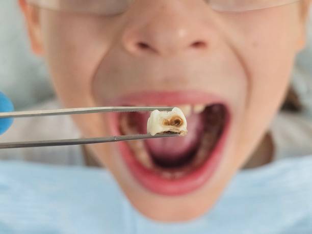 Best Emergency Gum Treatment in Selbyville, DE